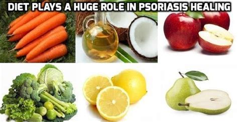 Psoriasis Diet: It works; one more successful story