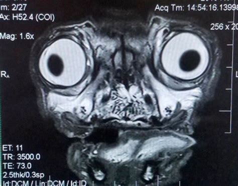 Pug dog has MRI scan and the results are giving people 'nightmares' - Mirror Online