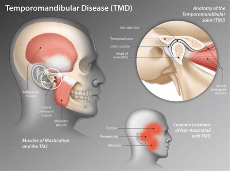 temporomandibular joint (TMJ) | HealthPlexus.net