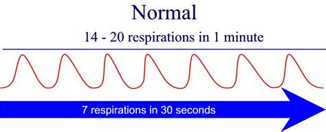 4.4 What factors are noted when taking a patient’s breathing rate and ...