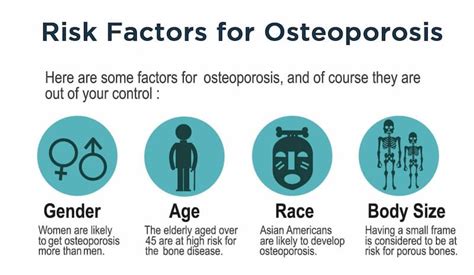 Osteoporosis: Early Signs and Risk Factors for Increasing the Chances of the Condition – SAPNA ...