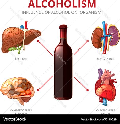 Long-term effects alcohol alcoholism Royalty Free Vector