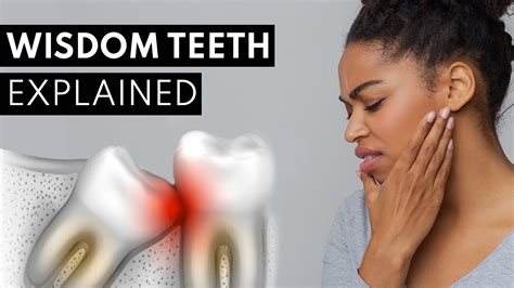 Do Wisdom Teeth Feel Like Teething? All Answers - Musicbykatie.com