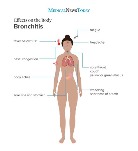 What are the symptoms of bronchitis?