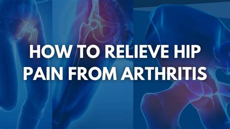 How to Relieve Hip Pain from Arthritis | OrthoCarolina