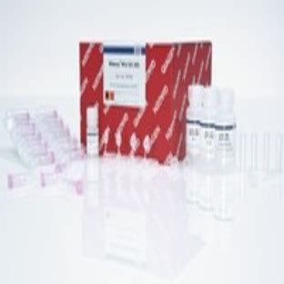 RNeasy Mini Kit (50), 74104 from Qiagen - Labsave