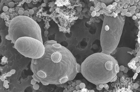 Saccharomyces Cerevisiae Electron Microscope