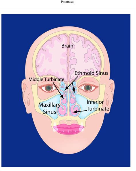 About Your Sinus & Nasal Passages - La Clínica de Rinosinusitis LLCSan ...