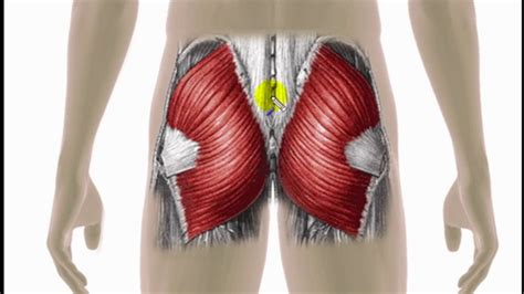 Gluteus Medius Trigger Point