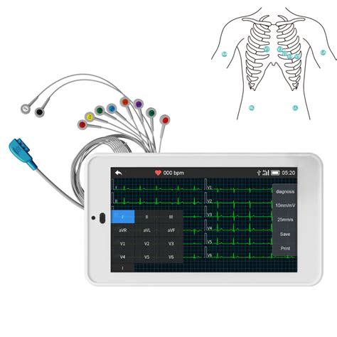 Point-of-Care EKG/ECG Machine Fits into Your Pocket, 6/12 Lead, with Auto Interpretation ...