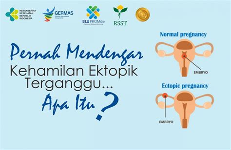 Setiap Perempuan Bisa Saja Mengalami, Begini Penyebab dan Dampak Hamil ...