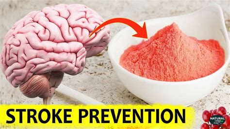 6 Natural Blood Thinners for Stroke Prevention - YouTube