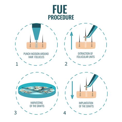 FUE Hair Transplant Procedure – Steps and Guidelines - Avrupa Hair Transplant