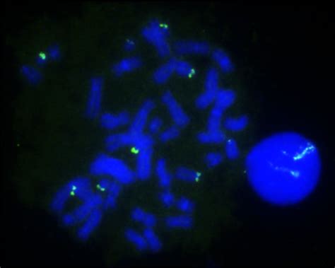 LSP NOR FISH Probe - CytoTest