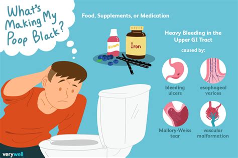 Black Stool: What Causes It and When to Visit the Doctor