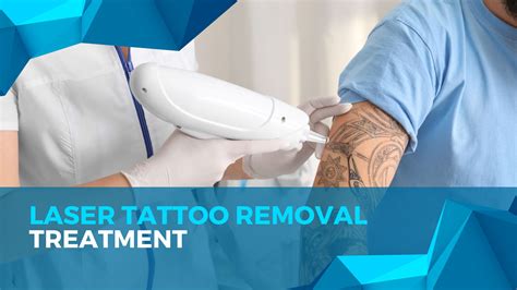 Best Laser Tattoo Removal in Mumbai, India | Cosmetic Dermatologist India