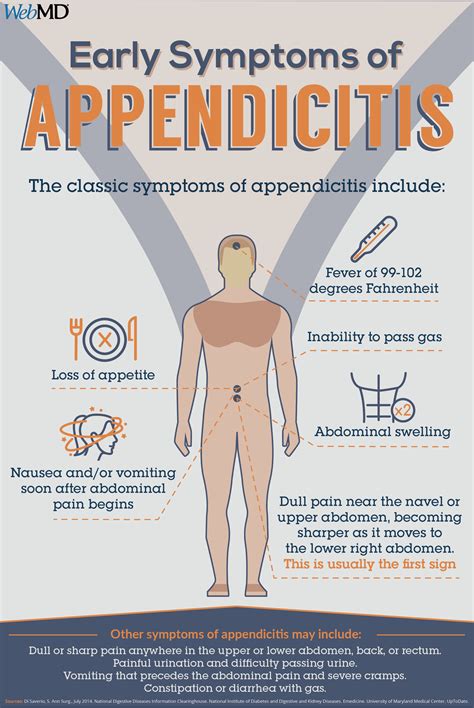 Appendicitis – Artofit