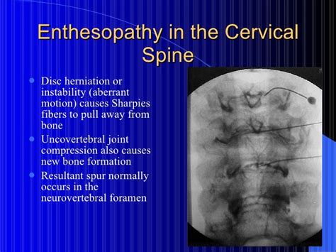 Understanding disorders of the spine| anatomy of the spine | chronic