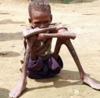 A Starving Child In Haiti | BelPoz