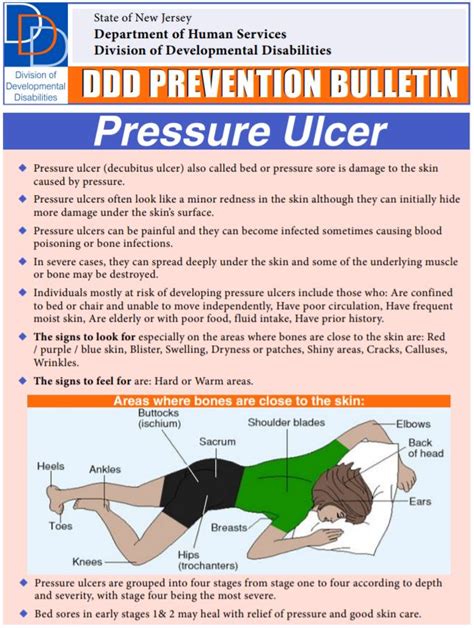 Preventing Pressure Ulcers - Care Lync