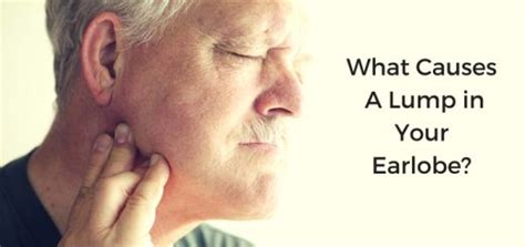 8 Causes & Treatments for Lump in Earlobe | Daily Health Cures