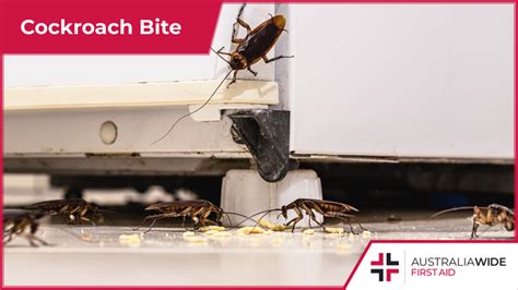 First Aid for Cockroach Bites | by Australia Wide First Aid | Medium