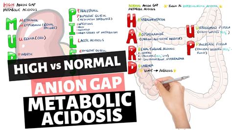 High vs Normal Anion Gap Metabolic Acidosis - Mnemonic (MUDPILES & HARD UP) - YouTube