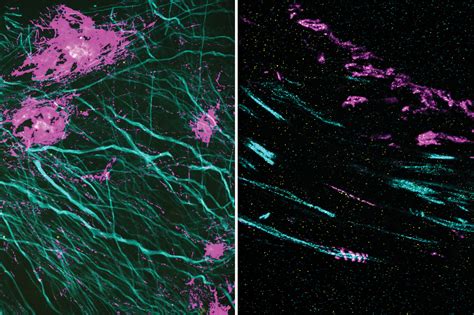 Microscopy technique reveals hidden nanostructures in cells and tissues ...