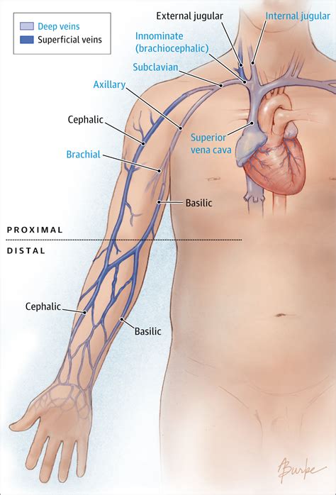 Nonleg Venous Thrombosis in Critically Ill Adults: A Nested Prospective ...