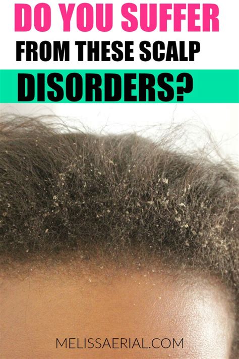 Some Scalp Disorders You Should Know About For Your Hair Health