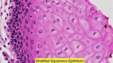 Stratified Squamous epithelium is found in(a) Pharynx(b) Trachea(c) Ileum(d) Bowman’s capsule