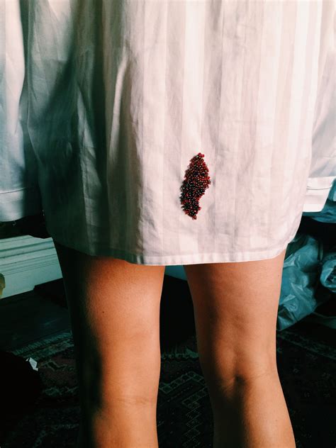 Pin on Menstruation