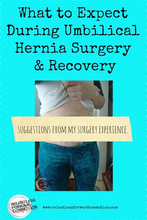 Ab Exercises After Hernia Surgery