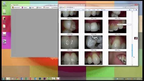 md960u Dental USB intraoral camera software use with Windows 7 Photo ...