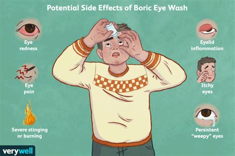 Boric Acid Eye Wash: Uses, Procedure, and Side Effects