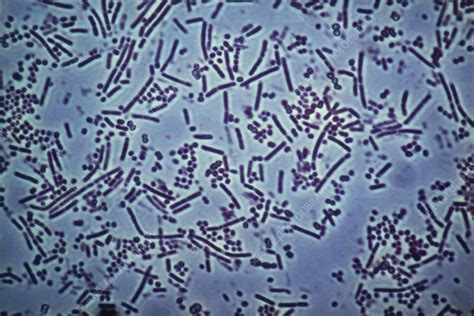 LM of bacteria taken from the human mouth - Stock Image - B220/0040 - Science Photo Library