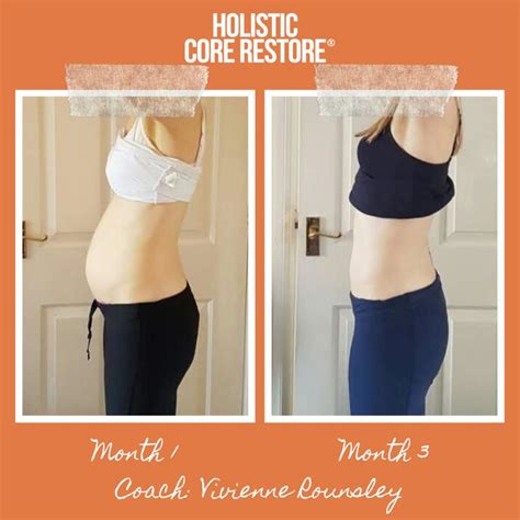 Before & After Diastasis Recti Repair Gallery - Holistic Core Restore