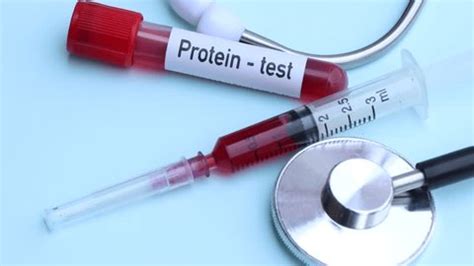 Protein Test Look Abnormalities Blood Blood Stock Footage Video (100% ...