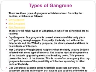 Gangrene | PPT