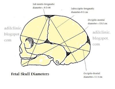 Fetal Skull Diameters, Diameter Of Skull Of Fetus at Time Of Delivery,