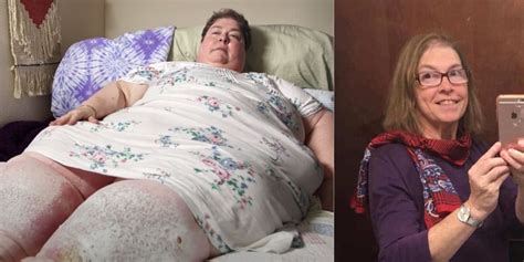 20 Incredible Before-And-After Photos From My 600-Lb Life