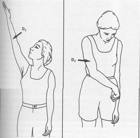 D2 PNF Patterns - Therapeutic Exercise Diagram | Quizlet