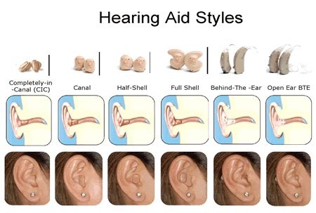 Ability Tools Weekly: History of Hearing Aids