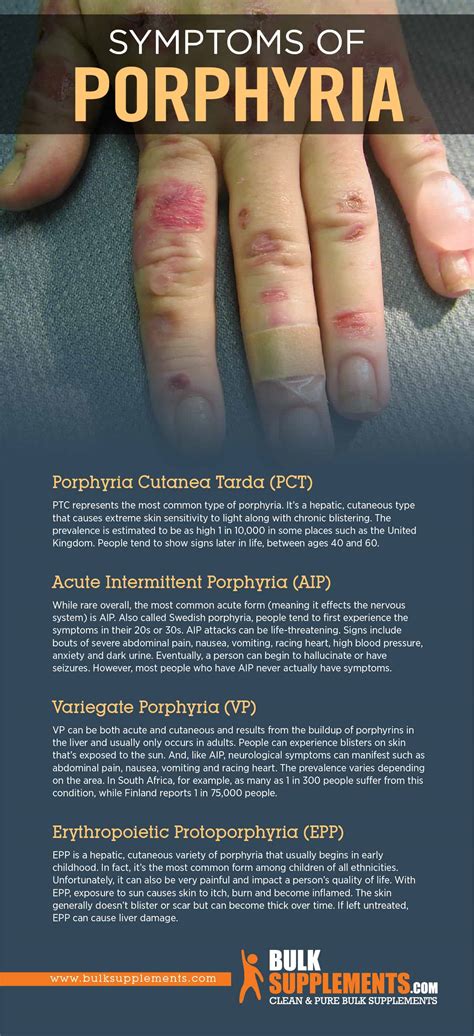 Porphyria: Symptoms, Causes & Treatments | BulkSupplements.com