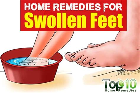 Home Remedies for Swollen Feet | Top 10 Home Remedies | Swollen feet remedy, Swollen feet, Water ...