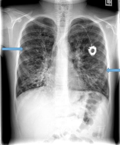 Pin on radiology