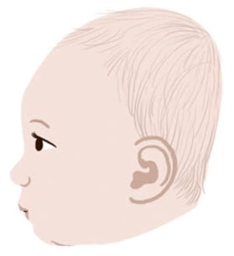 Brachycephaly: 10 Things You Need to Know