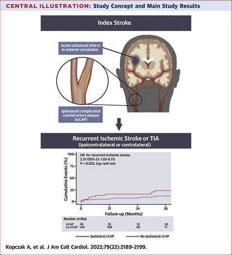 Complicated Carotid Artery Plaques and Risk of Recurrent Ischemic ...