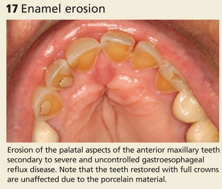 Oral Lesions You Can’t Afford to Miss | Clinician Reviews