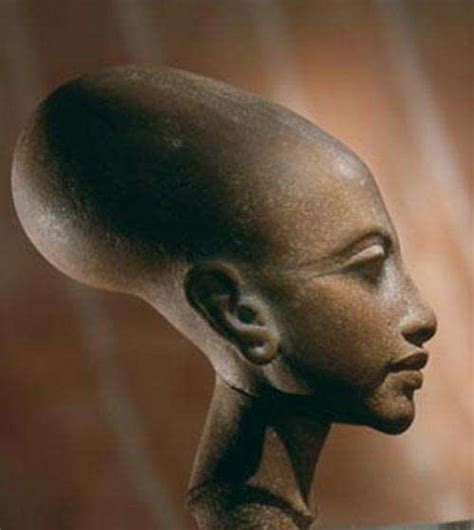 Elongated Skulls from Africa